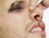 После алкоголя идет кровь из носа После очищения организма может скакать давление